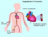 Alila-Medical-Images-Fotolia-com30[1]