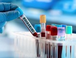 Technician holding blood tube test in the research laboratory