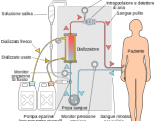 Hemodialysis-it.svg[1]