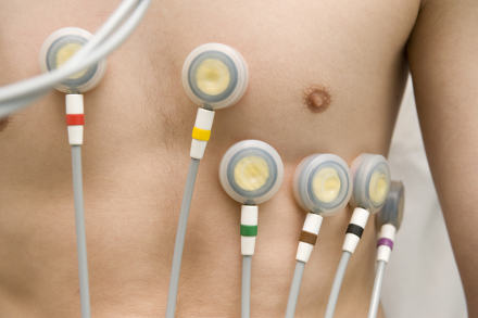 Electrocardiogram