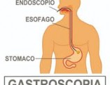 images endoscopia