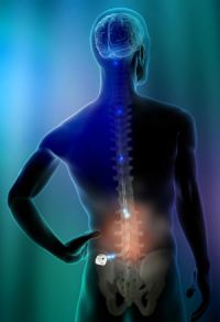 neurostimolazione