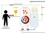 plasmaferesi_infografica